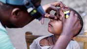 Foundation carries out 100,000th trachoma surgery in Ethiopia