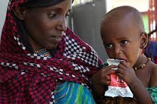 Canada assists children with malnutrition in Ethiopia