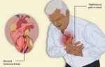 Awareness gap causes heart failure in Middle East, Africa